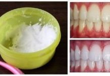 Home Remedy-DIY Natural Teeth Whitening with 2 Ingredients (Video) Home Remedy: DIY Natural Teeth Whitening at Home (Video)