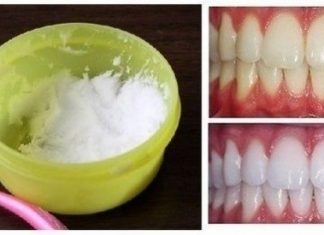Home Remedy-DIY Natural Teeth Whitening with 2 Ingredients (Video) Home Remedy: DIY Natural Teeth Whitening at Home (Video)