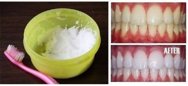 Home Remedy: DIY Natural Teeth Whitening at Home (Video)